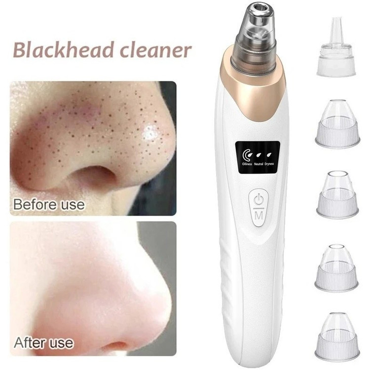 دستگاه میکرودرم پاکسازی صورت خانگی